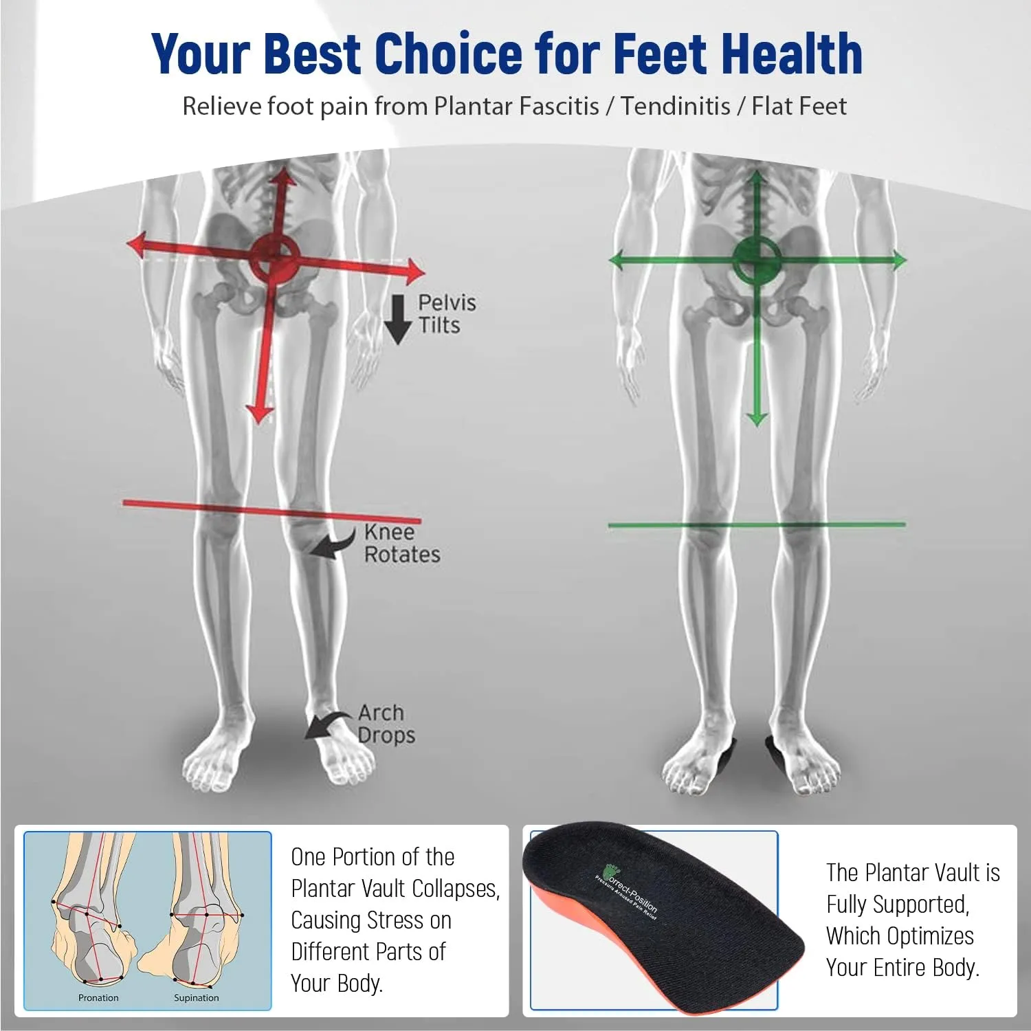 Plantar Fasciitis Relief Arch Support Shoe Inserts for Women and Men, Heel Cup for Heel Pain Relief, Achilles Tendonitis Relief and Max Anti-Shock, Heel Pads for Heel Spur Relief and Heel Lift